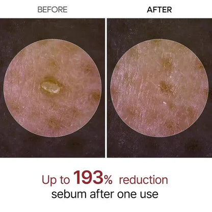 DM Rice Peel Ampoule